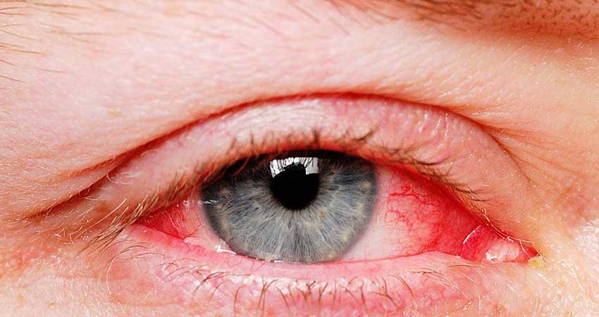 علائم ترک اعتیاد گل